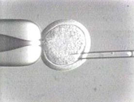 Egg Manipulation